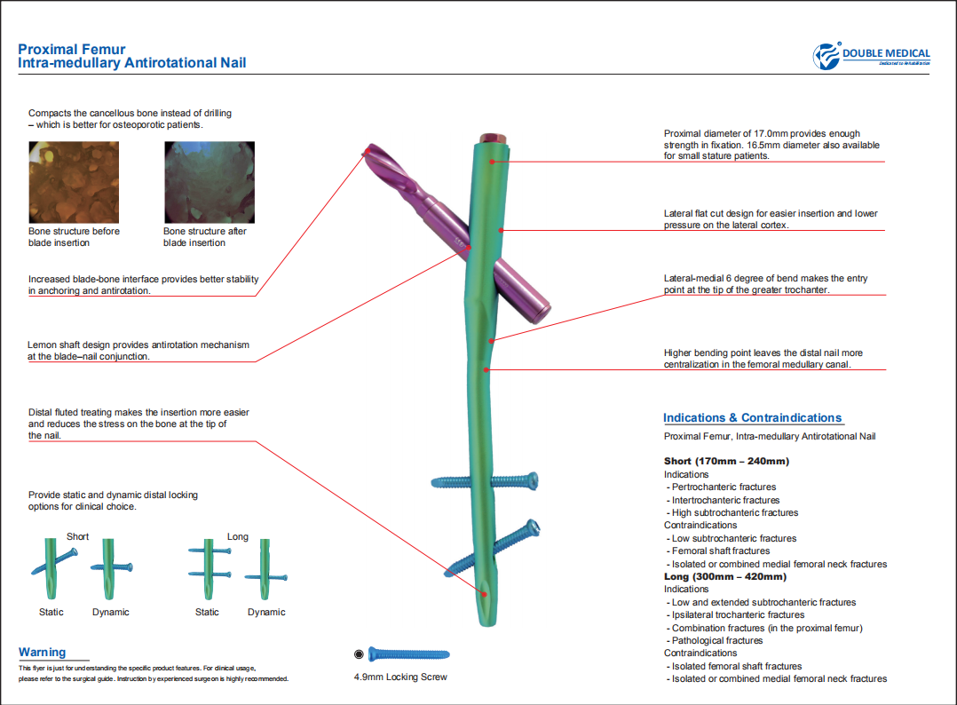 intraHEAL Proximal Femoral Nail, Long Manufacturer, Supplier & Exporter |  India