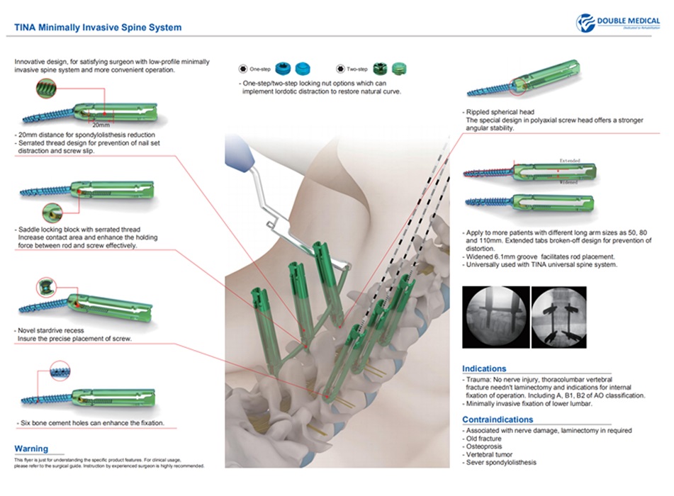 Minimally Invasive Pedicle Screw System