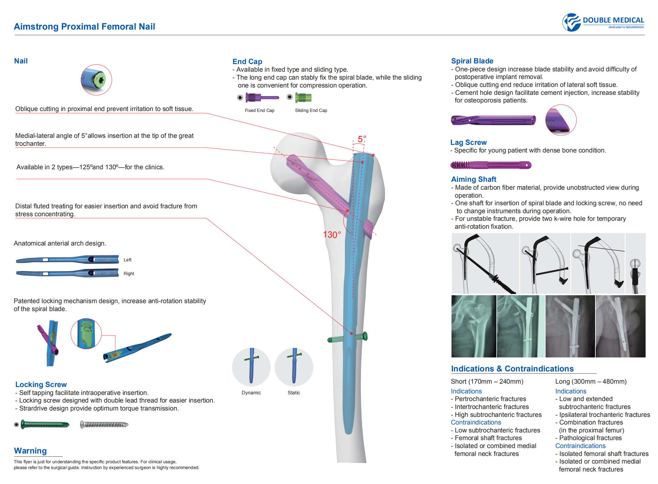 PFN Proximal Femoral Nail