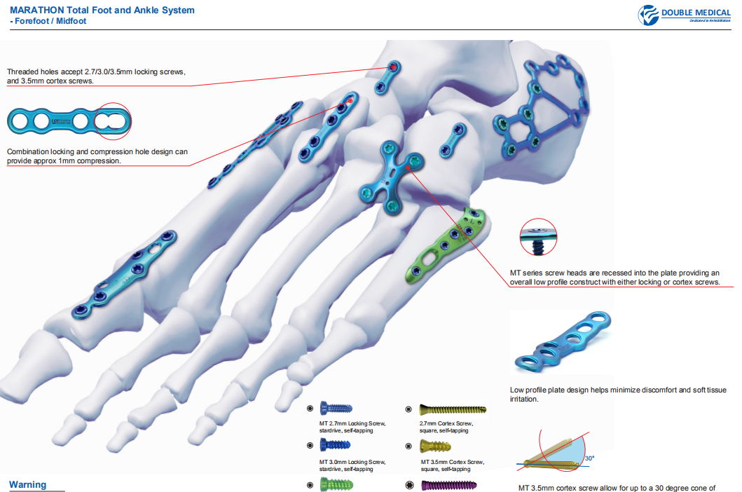 Marathon total foot and ankle system forefoot/midfoot