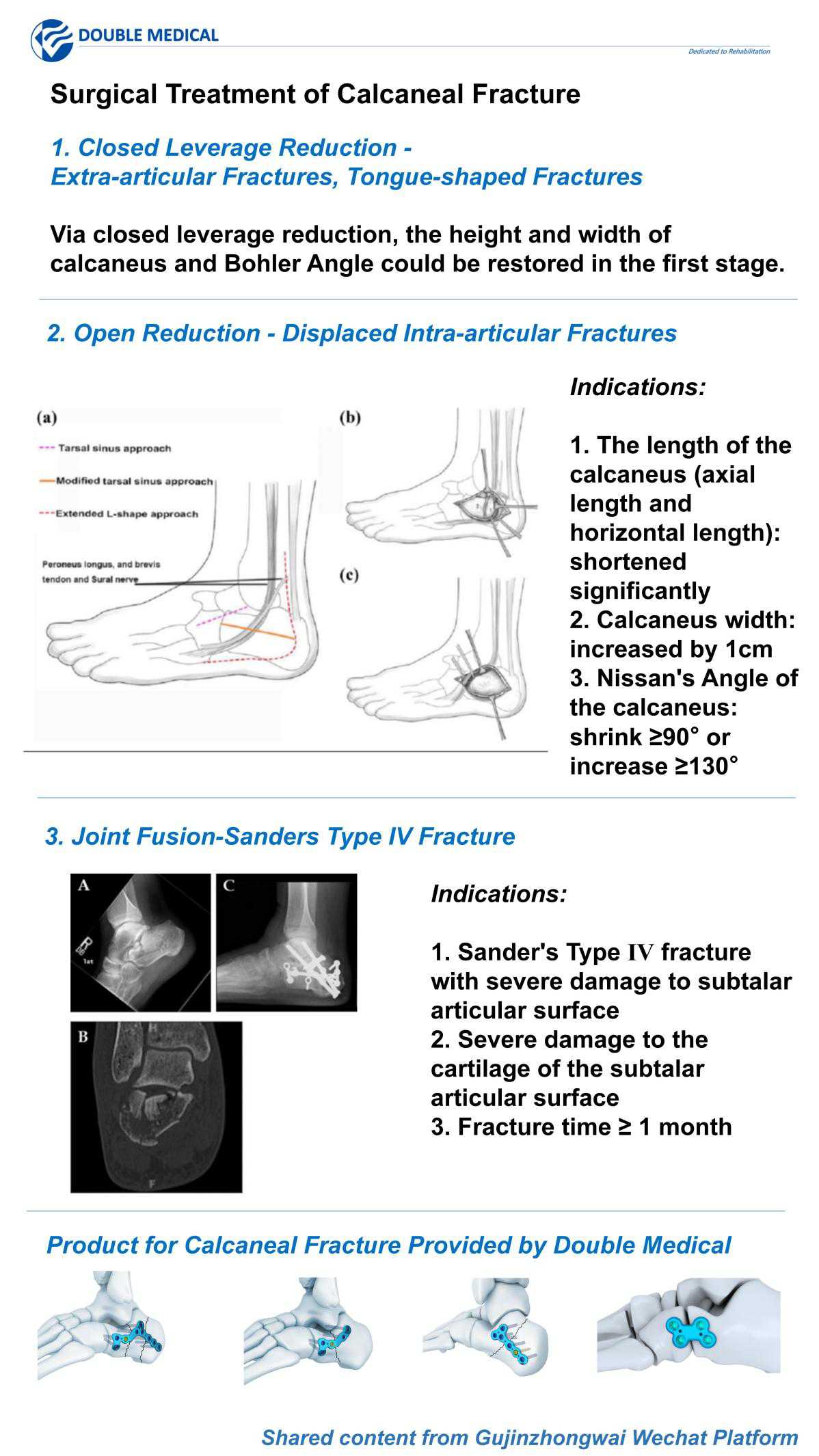 surgical treatment of calcaneal fracture