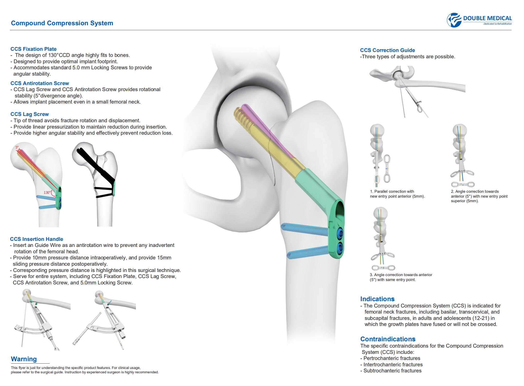 A Comparative Study on Internal Fixation Using Long Proximal Intramedullary  Nail for the Treatment of Humeral Shaft Fracture according to Fracture Types