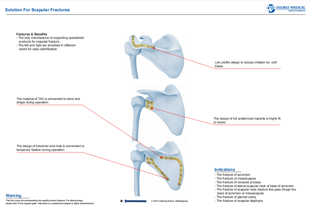 Acumed Scapula Plating System Precontoured Scapula Compression Plate