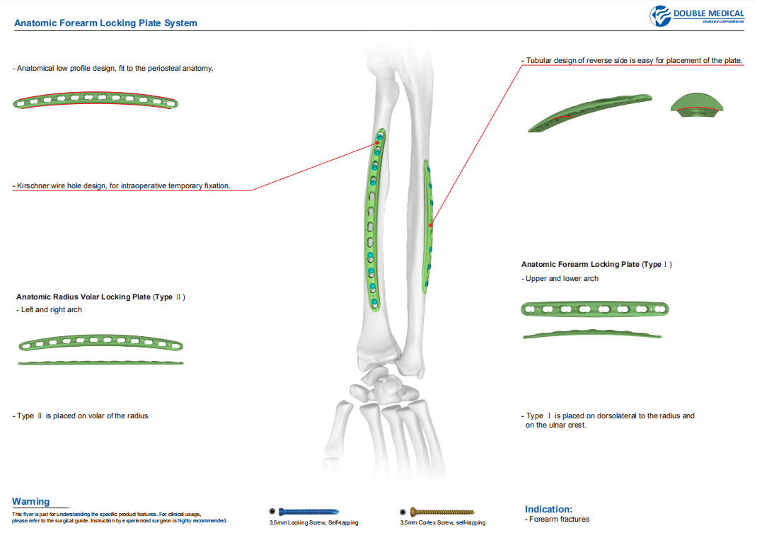 Midshaft Volar Radius Plates Acumed Anatomic Midshaft Forearm Plating System