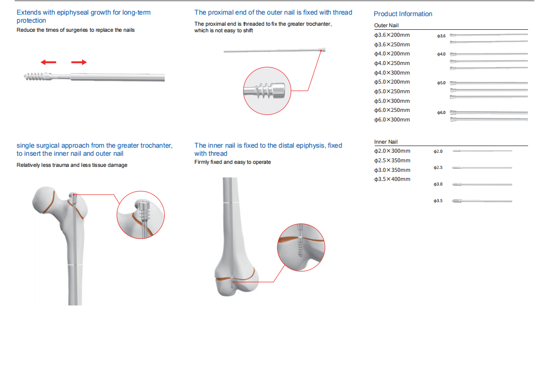 SN Pediatric Slide Intramedullary Nail System