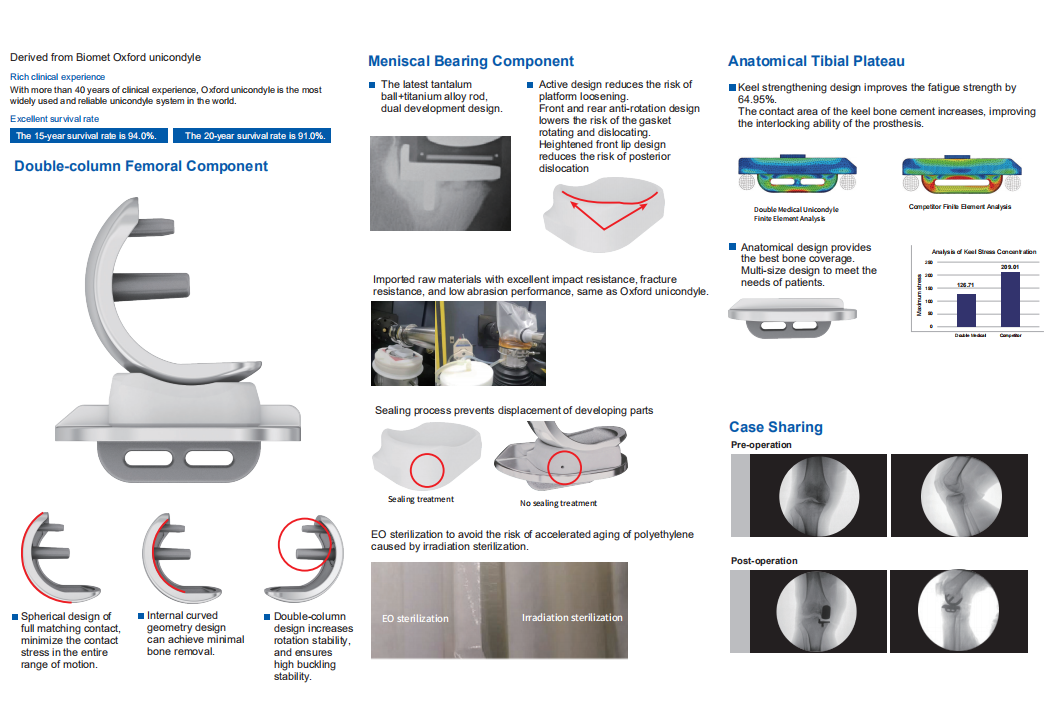 Unicompartmental Knee Joint System