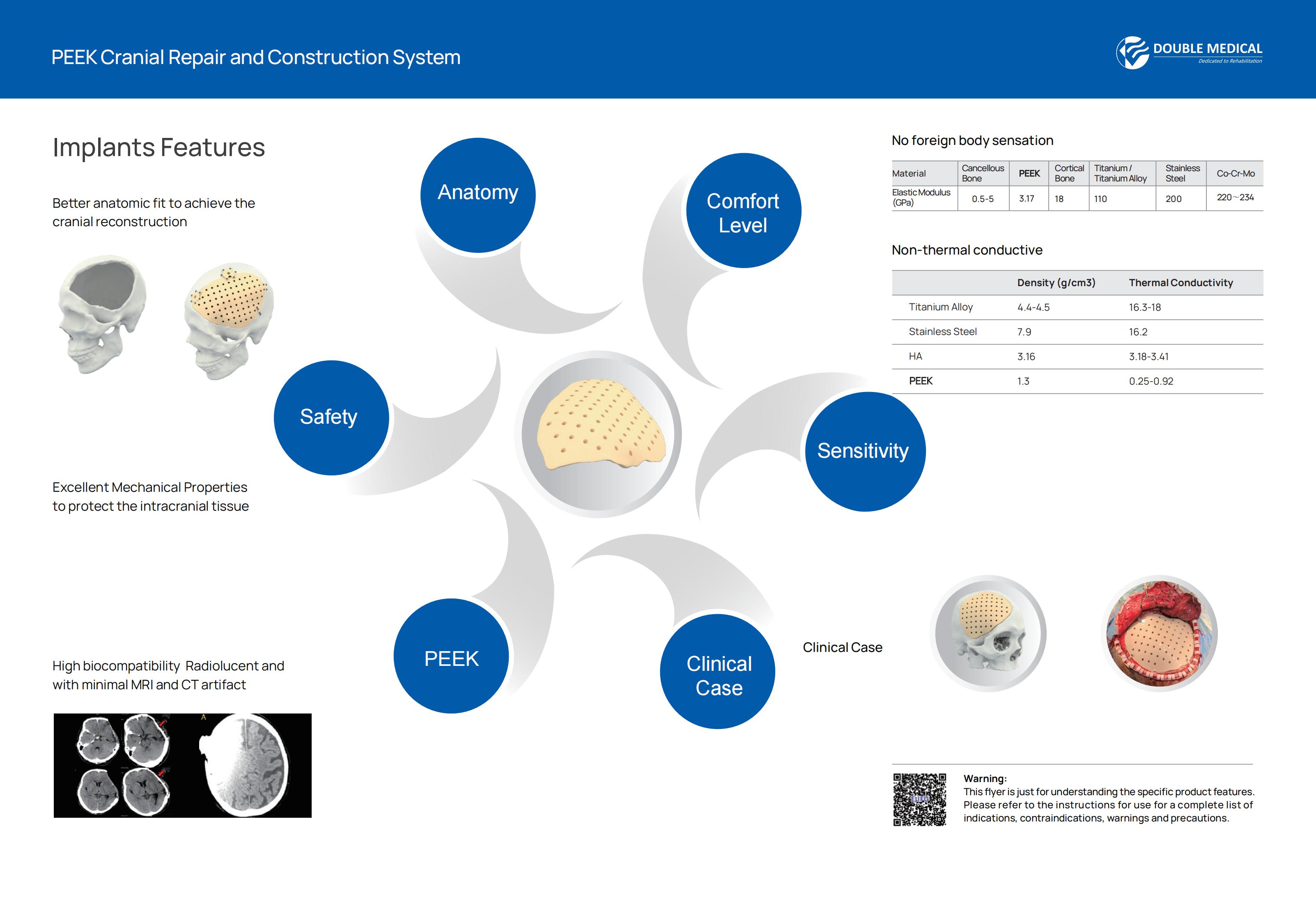 PEEK Cranial reconstruction implant