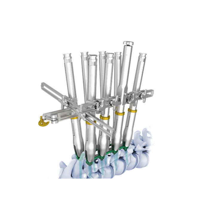 Direct Vertebral Rotation System