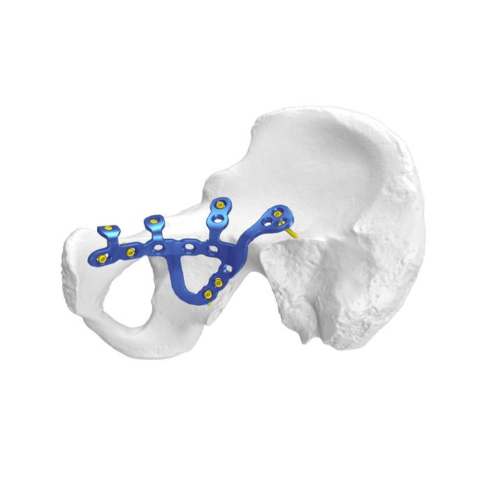 Anatomical Pelvic Acetabular Locking Plate