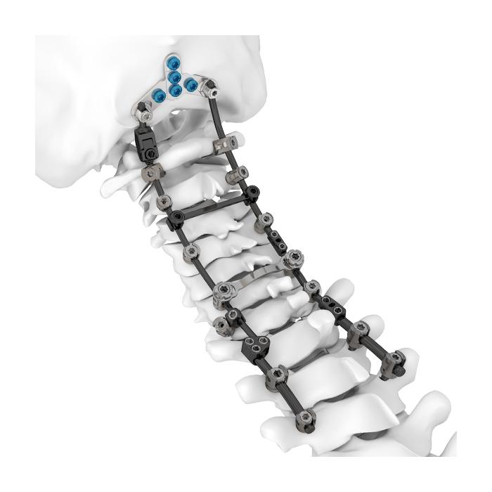 HOBBIT Posterior Cervical Spine 3.5/4.0 System