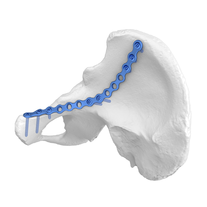 Flexible Acetabular Plate (FAP) System Iliopubic Anterior Column Anatomic Locking Plate