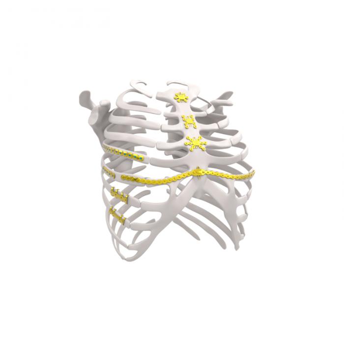 Thorax System