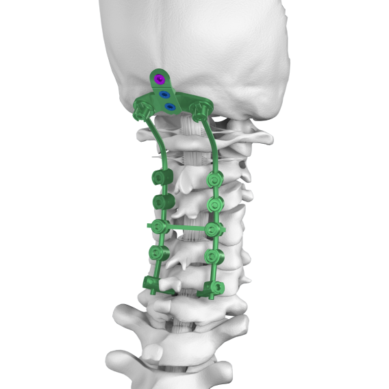 Solutions for Posterior Cervical