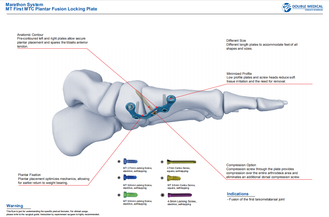 *MT First MTC Plantar Fusion Locking Plate* digunakan untuk fusi sendi tarsometatarsal pertama yang tidak stabil dan fusi sendi tarsometatarsal pertama.