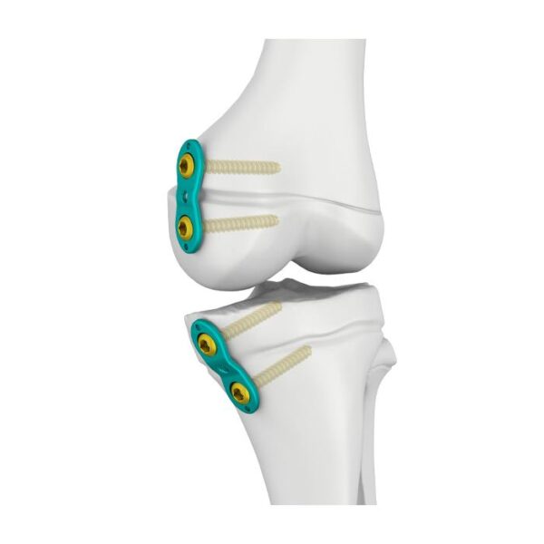 3.0/4.5mm Epiphyseal Plate