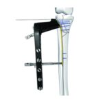 Lateral Tibial Head Buttress Locking Plate Ⅱ