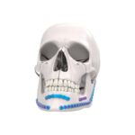 Mandible Fixation System