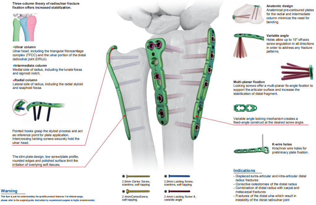 Distal Radioulnar Locking Plates 1 원위 요척골 잠김 금속판은 요척골 골절 고정의 3기둥 이론에 기반하여 설계되어 안정성을 높입니다.