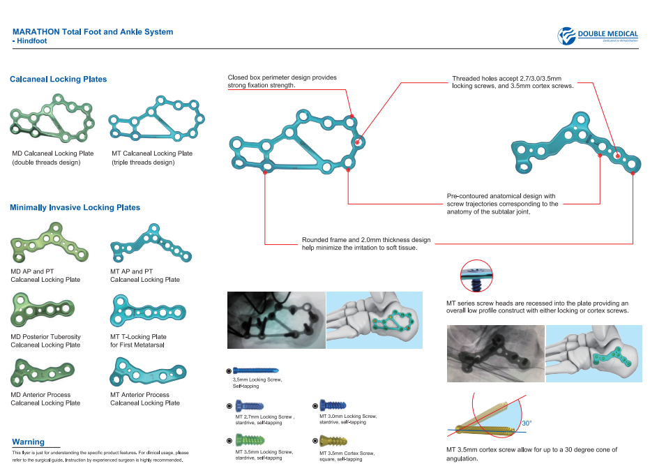 MT Anterior Process Calcaneal Locking Plate 1 MT Anterior Process Calcaneal Locking Plate is used for Calcaneal anterior process fracture.