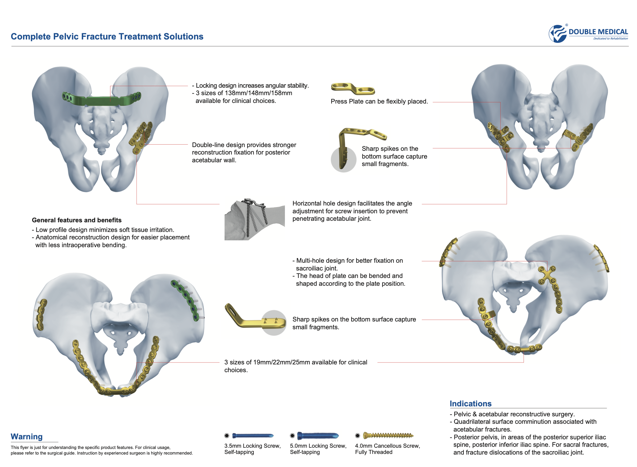 The Anatomical Iliopubic Plate is an anatomical pre‑contoured locking implant for pelvic and acetabular fracture reconstruction. Its low‑profile design reduces soft‑tissue irritation. Bottom spikes grip small bone fragments, while optimized screw holes prevent acetabular joint penetration. Multiple sizes accommodate varied pelvic anatomies, delivering stable fixation for quadrilateral surface comminution, sacroiliac joint fracture‑dislocations and other complex pelvic trauma.