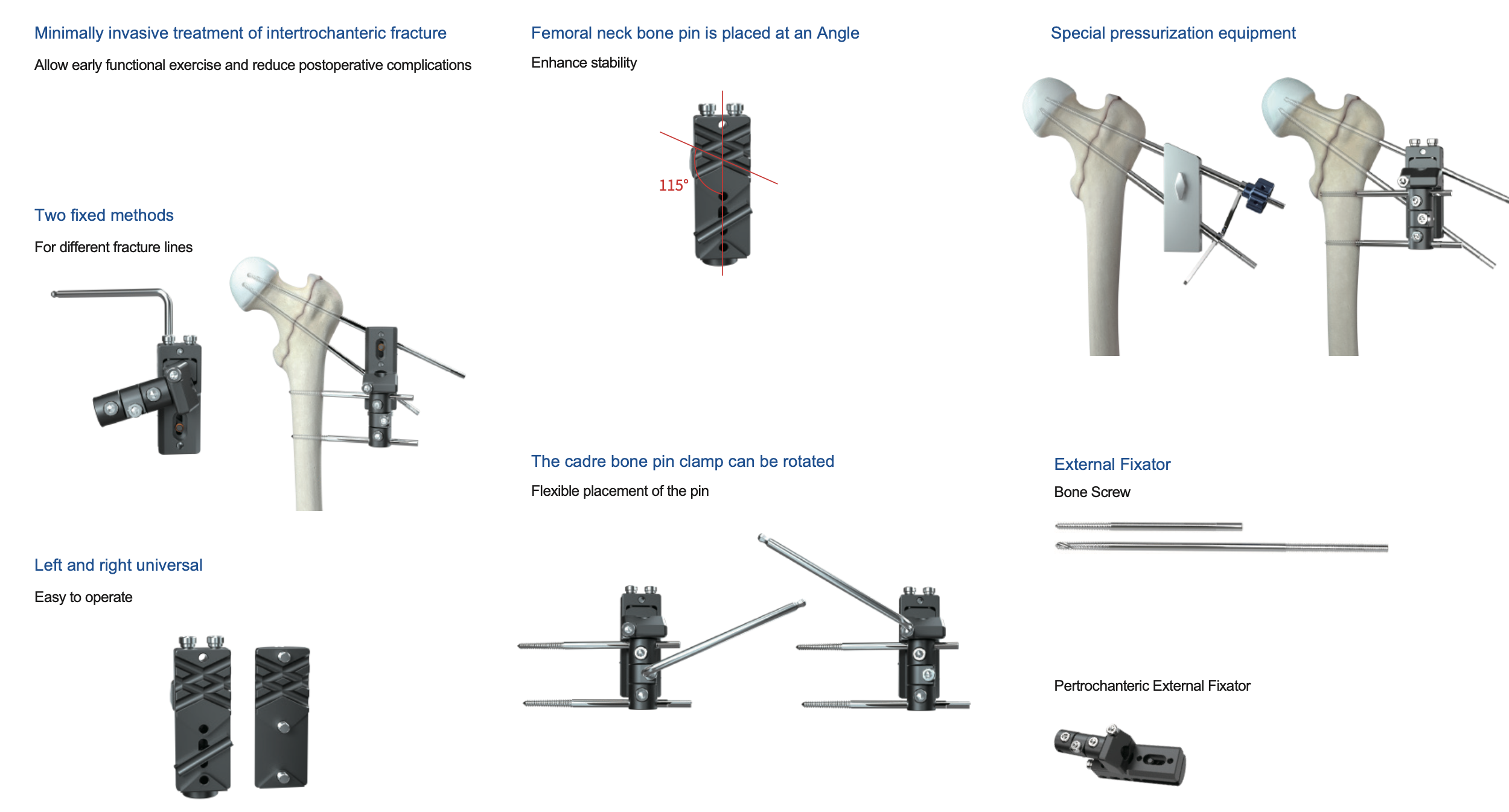 Pertrochanteric External Fixator 1 This pertrochanteric external fixator enables minimally‑invasive treatment for intertrochanteric fractures. Designed with 115° angled femoral neck pin placement and rotatable bone pin clamps for flexible pin insertion. Supports two fixation modes, left‑right universal compatibility and special pressurization function. Facilitates early postoperative functional exercise and lowers complication risks.