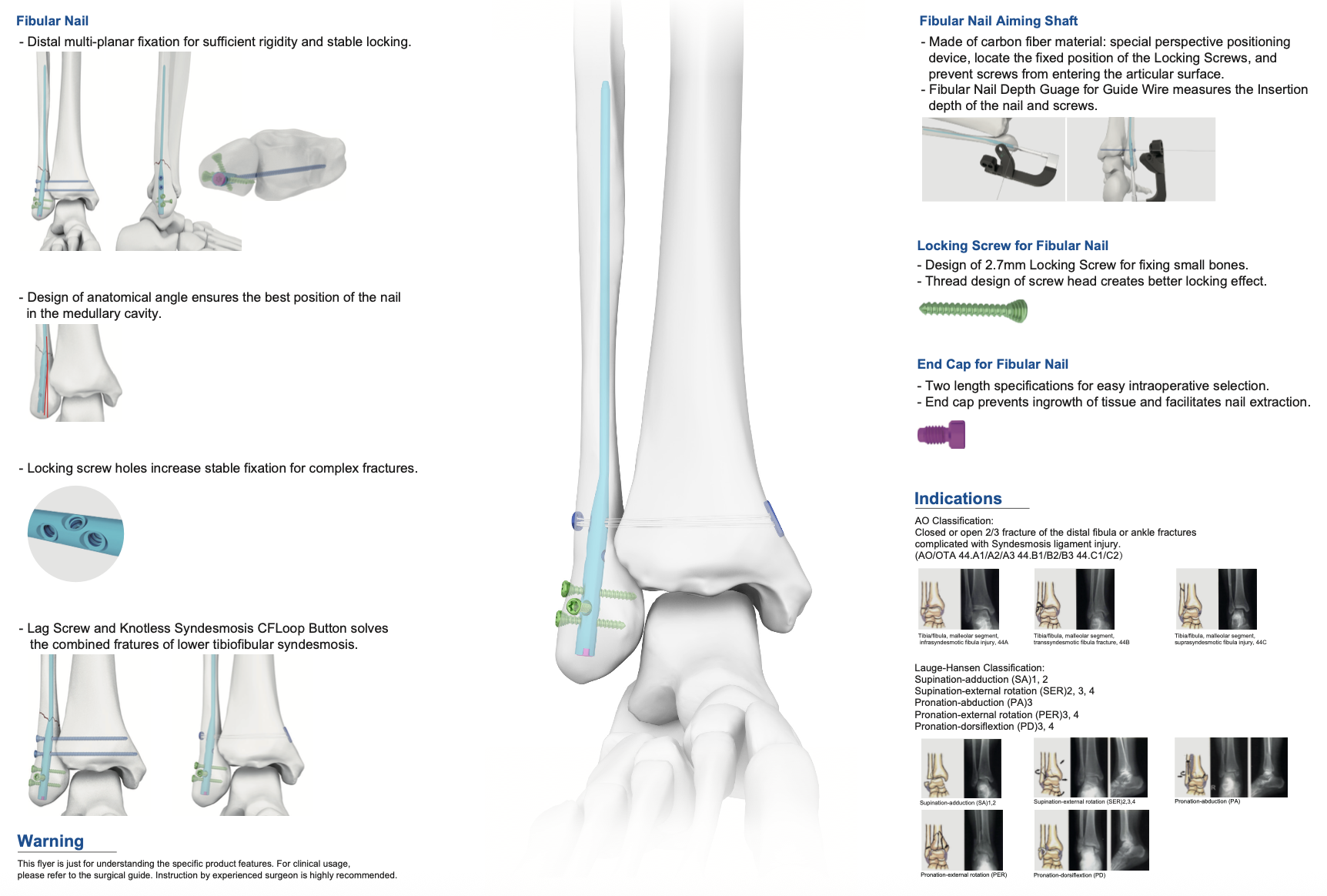 Fibular Nail 2 The Fibular Nail system delivers rigid multi‑planar distal locking with anatomical‑angled nail design for optimal intramedullary fit. 2.7 mm locking screws provide secure fixation for small‑bone anatomy. The dedicated aiming shaft facilitates accurate screw placement and avoids articular surface violation. End caps block soft‑tissue ingrowth and simplify nail removal. Multiple diameters, lengths and left‑right variants cover distal fibular and complex ankle syndesmosis‑related fractures.