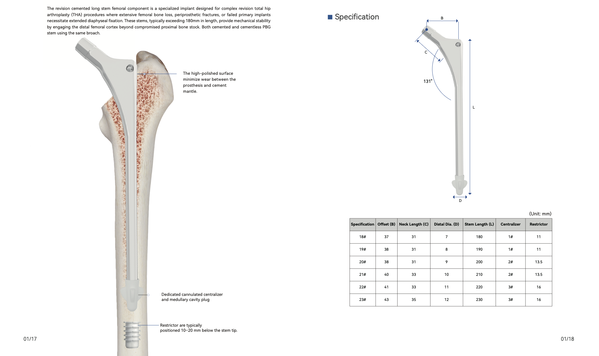 PBG Revision Cemented Hip Stem 1 Specially designed for complex revision total hip arthroplasty, indicated for massive femoral bone loss, periprosthetic fractures and failed primary implants. It achieves mechanical stability via distal diaphyseal fixation. High‑polished surface reduces wear between prosthesis and cement mantle. Equipped with dedicated cannulated centralizer and medullary plug to ensure reliable cement sealing for severe bone‑defect revision cases.