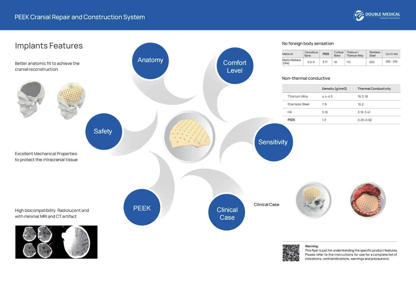 Comment choisir le meilleur matériau pour la cranioplastie ? La cranioplastie est une procédure critique utilisée pour réparer les défauts crâniens causés par un traumatisme, une craniectomie décompressive, une résection tumorale ou des affections congénitales. L’une des décisions les plus importantes dans la reconstruction crânienne est le choix du matériau d’implant approprié.