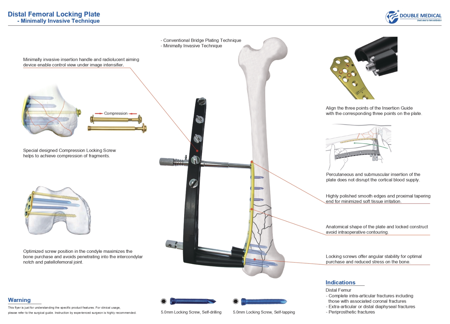 Fracture fixation is a fundamental part of orthopedic trauma care, helping restore bone alignment, maintain fracture stability, and create favorable conditions for bone healing. Among the various fracture fixation methods available today, plate fixation is widely used to treat fractures across different anatomical regions. Within modern plate fixation, locking plates have become an important solution for managing a wide range of fracture patterns.