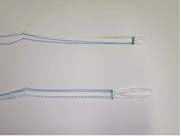 ACL Reconstruction: Graft Fixation Methods, Techniques and Key Considerations 4 ACL interference screw fixation compressing graft against bone tunnel wall, PEEK and bioabsorbable screw options