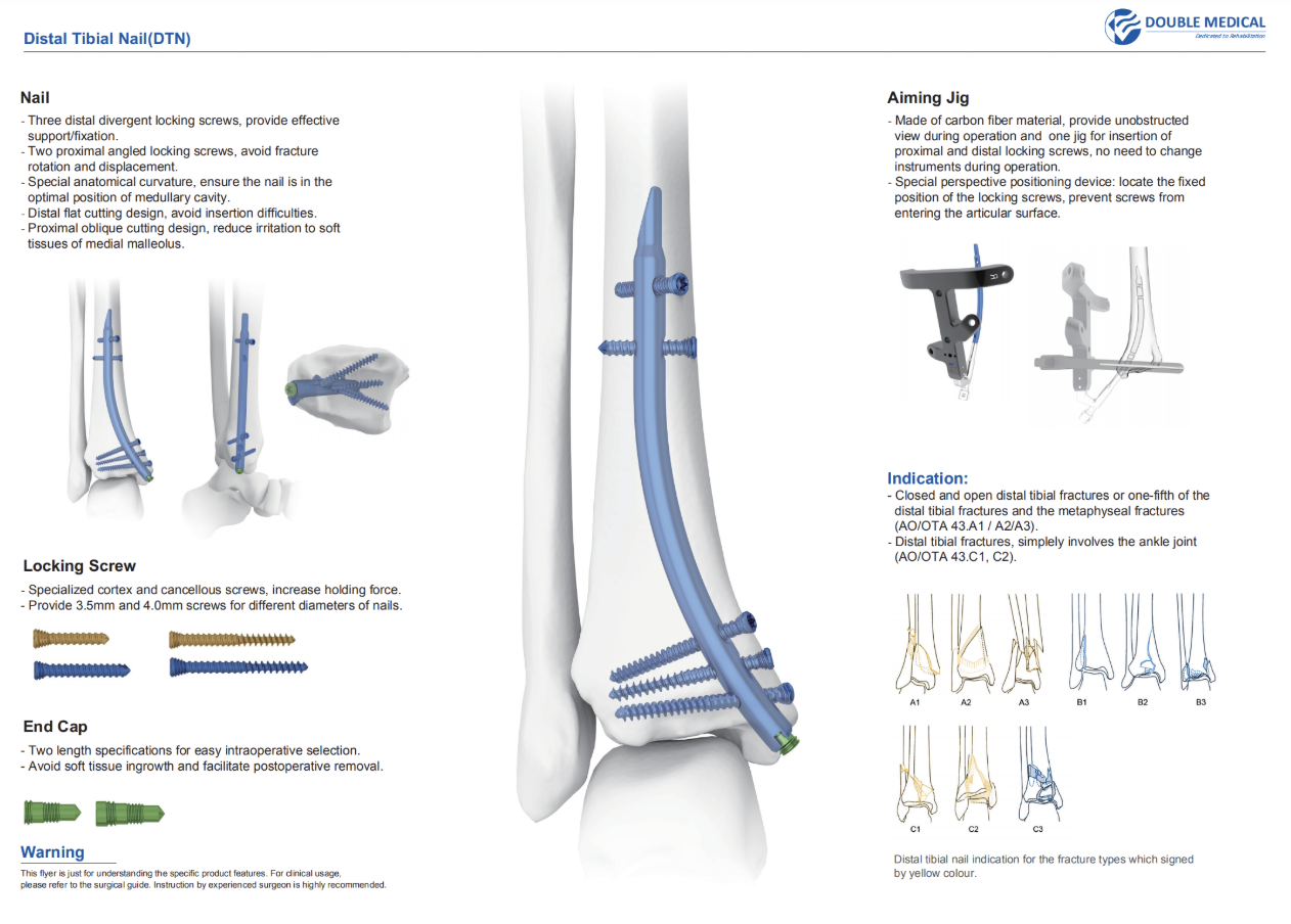 Distal Tibial Fracture Treatment: When Is Intramedullary Nailing Used? 1 Distal tibial fractures can be challenging to treat because the distal tibia has limited soft-tissue coverage and is located close to the ankle joint. Treatment decisions depend on the fracture pattern, degree of displacement, articular involvement, bone quality, and condition of the surrounding soft tissues.